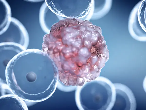 PI3 kinase inhibitors